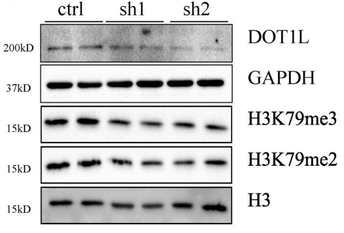 Protein expression of DOT1L.jpg